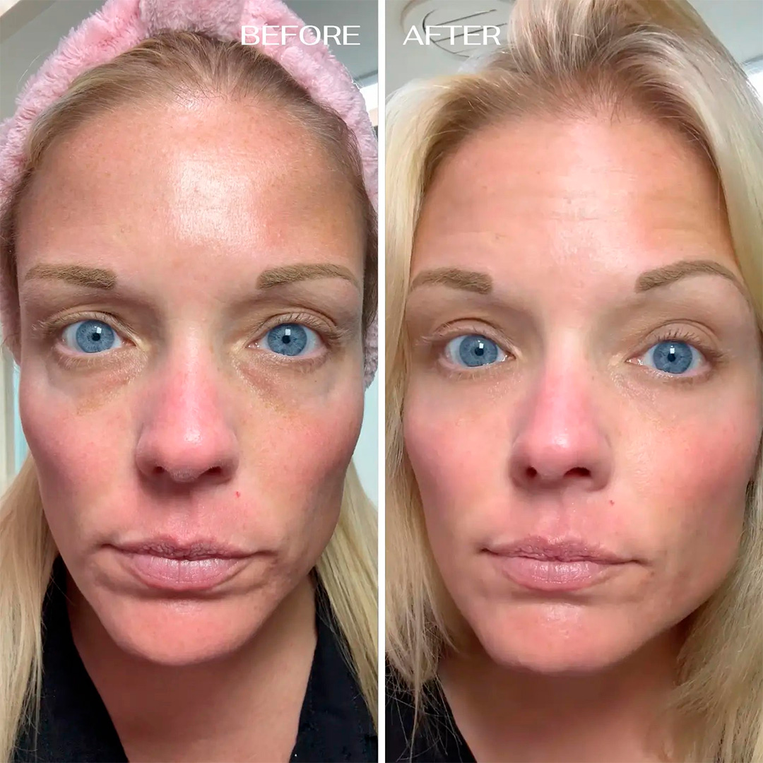 Ultimate Alpha Stack